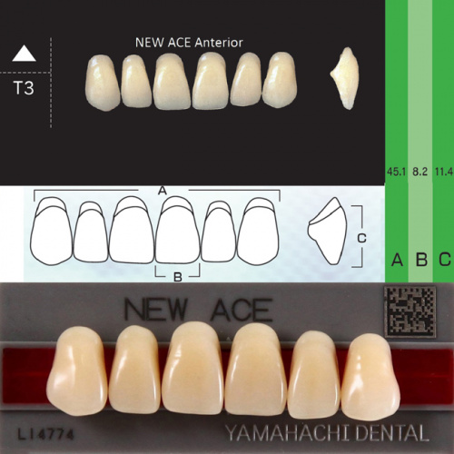 Зубы NEW ACE Anterior, цвет D4, фасон T3 акриловые двухслойные, 6 шт.